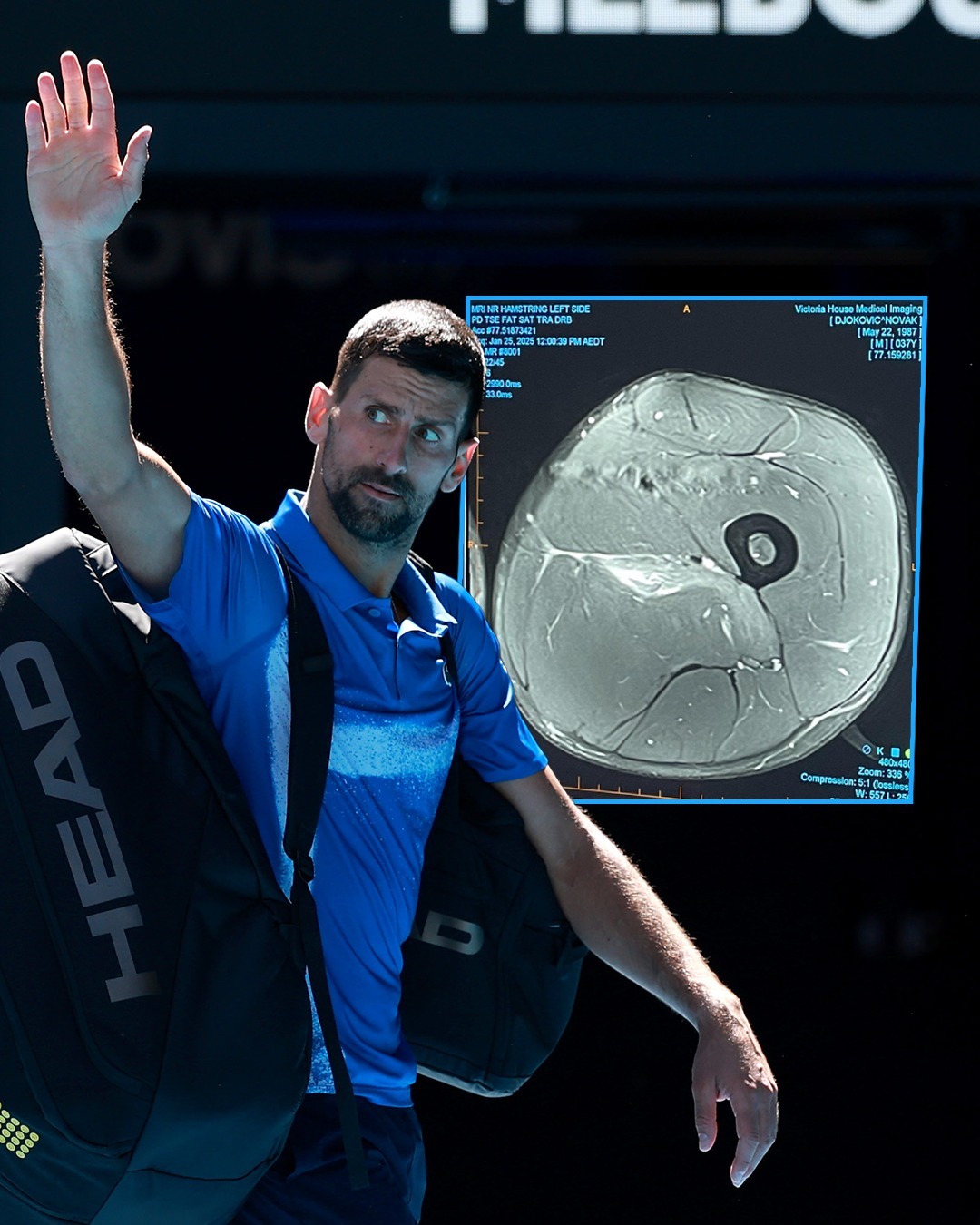 包含西班牙网球队强势世界网球队,德约科维奇送出助攻的词条 包含西班牙网球队强势世界网球队,德约科维奇送出助攻的词条